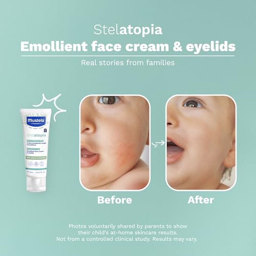 Image 6 of Mustela Stelatopia Eczema-Prone Skin Emollient Baby Face Cream - 1.35 Fl Oz (Pack of 1)