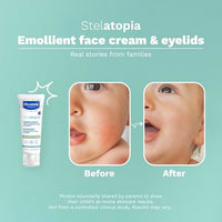 Thumbnail for Image 6 of Mustela Stelatopia Eczema-Prone Skin Emollient Baby Face Cream - 1.35 Fl Oz (Pack of 1)