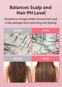 Thumbnail for Image 5 of A'PIEU Raspberry Vinegar Shampoo for Dandruff & Buildup