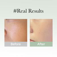 Thumbnail for Glow Hyssop Overnight Face Mask Serum - hydrating & Anti-Aging Serum for younger looking Korean Glass Skin, 30% Vitamin A, C, E, 10% Niacinamide, Peptide