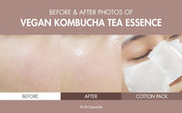 Thumbnail for Dr.Ceuracle Vegan Kombucha Cream Essence Toner - Korean Skincare Hydrating Milky Toner with Kombucha Tea Extract, Centella Asiatica, Ceramide (150 ml / 5.07 fl. oz.)