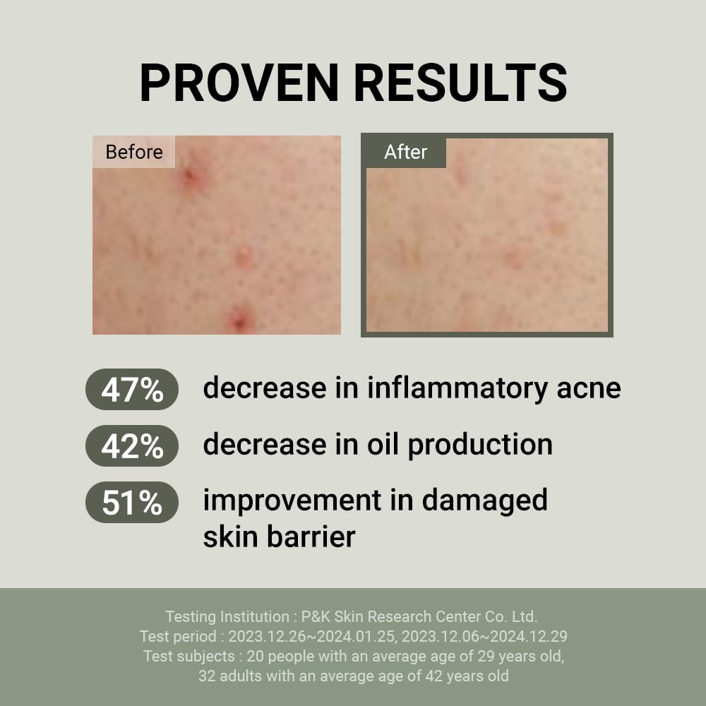 JUMISO Snail Mucin 88 Peptide Cream - Korean Face Moisturizer 5-Peptide Complex Collagen Boost Hyaluronic Acid Niacinamide Damaged Skin Repair - Sensitive Skin Non-Comedogenic 3.38 oz.