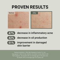 Thumbnail for JUMISO Snail Mucin 88 Peptide Cream - Korean Face Moisturizer 5-Peptide Complex Collagen Boost Hyaluronic Acid Niacinamide Damaged Skin Repair - Sensitive Skin Non-Comedogenic 3.38 oz.