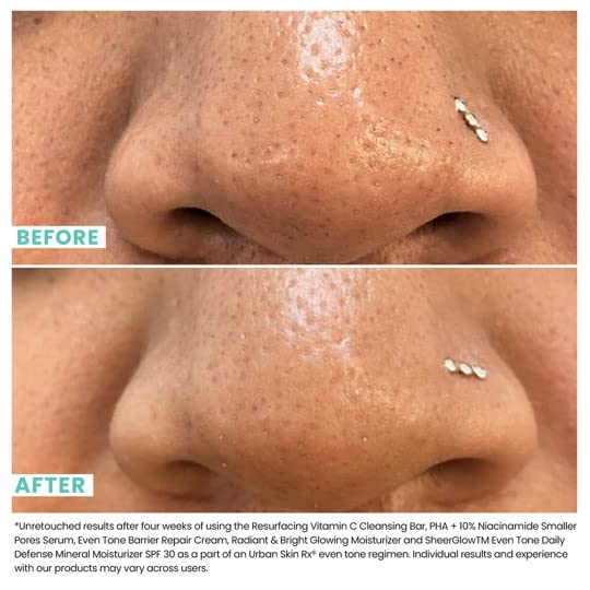 Urban Skin Rx® PHA + 10% Niacinamide Smaller Pores Serum, Tightens Pores for Clear, Brighter & Smoother Skin, Exfoliates, Decongests, Controls Excess Oil, & Fights Against Future Breakouts, 1 Fl Oz.