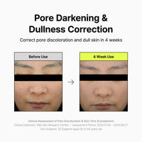 Thumbnail for By Wishtrend Pore Smoothing Bakuchiol Serum 1.01 Fl Oz, Pore Minimizer Enhanced with Bakuchiol & Niacinamide, Peptide, Increase production of Collagen Fiber, for saggy & enlarged pores