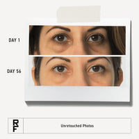 Thumbnail for RODAN + FIELDS Active Hydration Bright Eye Complex | 15ml | Moisturizing Under Eye Cream for Dry Skin | Eye Treatment for Refreshed Appearance | Skincare
