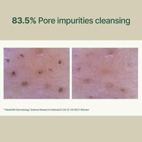 Thumbnail for Pyunkang Yul Calming Low pH Foaming Cleanser | Daily Face Wash & Makeup Remover with Tea Tree, Centella Asiatica, 5 Hyaluronic Acids that Removes Dead Skin Cells, Hydrates Skin - 150ml 5.07 Fl.Oz.