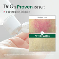 Thumbnail for Dr. G R.E.D. Blemish Clear Soothing Toner - Korean Soothing Toner for Glowing Skin - Soothes Irritation Clear Skin - Mild Exfoliant - with AHA, BHA & Centella Asiatica - 10.14 fl oz