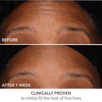 Thumbnail for Dr Dennis Gross DermInfusions Fill + Repair Serum: Immediately Fills Lines, Plumps & Repairs, 1 oz