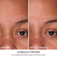 Thumbnail for Dr Dennis Gross DermInfusions Fill + Repair Serum: Immediately Fills Lines, Plumps & Repairs, 1 oz
