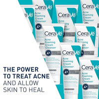 Thumbnail for CeraVe Acne Foaming Cream Cleanser, 4% Benzoyl Peroxide Face Wash With Hyaluronic Acid, Niacinamide & Ceramides, Gentle Daily Acne Treatment For Face