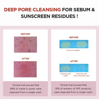 Thumbnail for SKIN1004 Madagascar Centella Poremizing Deep Cleansing Foam 4.22 fl.oz, 125ml, Remove Pore-Clogging Debris