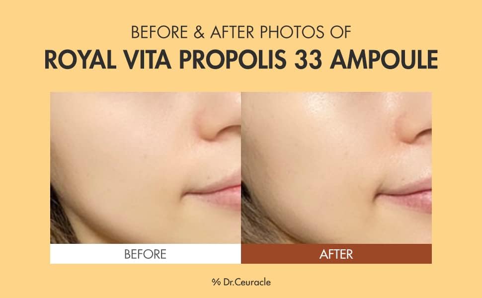 Dr.Ceuracle Royal Vita Propolis 33 Ampoule - Korean Ultimate Glow and Nourish Vitamin Serum for Radiant Skin, Formulated with Propolis and Royal Jelly Extract (30 ml / 1.01 fl. oz.)