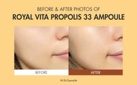 Thumbnail for Dr.Ceuracle Royal Vita Propolis 33 Ampoule (30ml / 1.01 fl. oz.) - Ultimate Glow and Nourish Vitamin Serum for Radiant Skin, Formulated with Propolis and Royal Jelly Extract