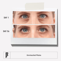 Thumbnail for RODAN + FIELDS Active Hydration Bright Eye Complex | 15ml | Moisturizing Under Eye Cream for Dry Skin | Eye Treatment for Refreshed Appearance | Skincare