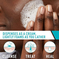 Thumbnail for CeraVe Acne Foaming Cream Cleanser, 4% Benzoyl Peroxide Face Wash With Hyaluronic Acid, Niacinamide & Ceramides, Gentle Daily Acne Treatment For Face