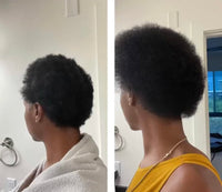 Thumbnail for BUR BUR Growing Season Hair Growth And Repair Oil | With Burdock, Nettle Oil and Vitamin C for Visibly Fuller, Stronger and Shinier Hair.