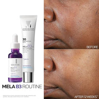 Thumbnail for La Roche-Posay Mela B3 UV Daily Sunscreen, Face Moisturizer With SPF 30 + Anti-Aging Melasyl + 5% Niacinamide, Helps Correct & Protect From Sun Damage, Face Sunscreen With No White Cast, 40ML