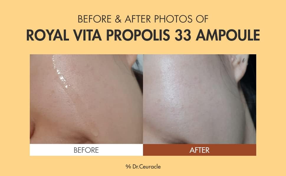 Dr.Ceuracle Royal Vita Propolis 33 Ampoule - Korean Ultimate Glow and Nourish Vitamin Serum for Radiant Skin, Formulated with Propolis and Royal Jelly Extract (30 ml / 1.01 fl. oz.)