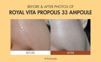 Thumbnail for Dr.Ceuracle Royal Vita Propolis 33 Ampoule (30ml / 1.01 fl. oz.) - Ultimate Glow and Nourish Vitamin Serum for Radiant Skin, Formulated with Propolis and Royal Jelly Extract