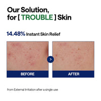 Thumbnail for Mediheal Teatree Calming Serum 1.35 fl.oz - Quick Skin Calming and Redness Relief - Sebum Care, Oil Moisture Balance & Deep Moisturization with Hyaluronic Acid