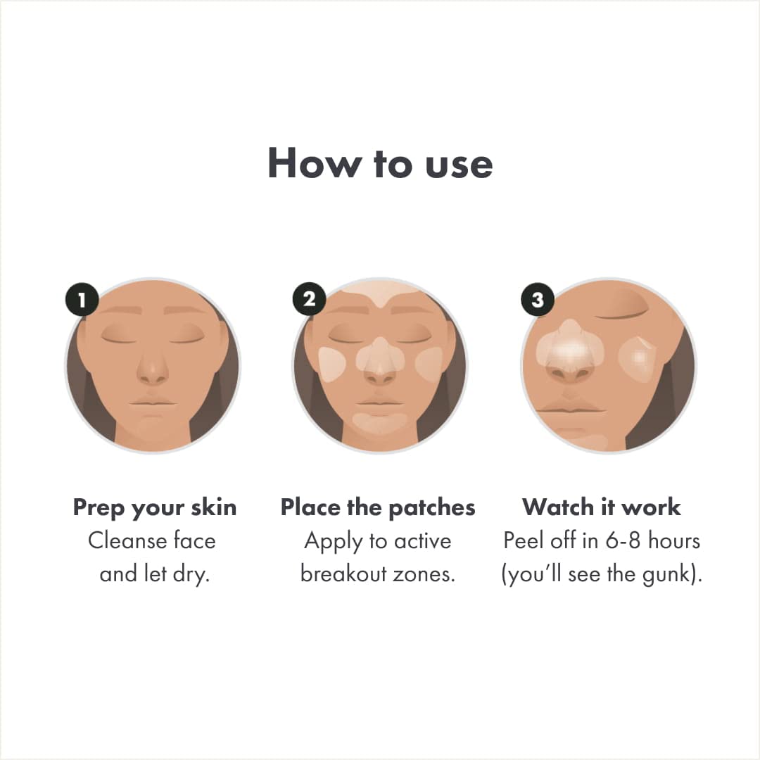 Mighty Patch™ Face Patch from Hero Cosmetics - XL Hydrocolloid Face Mask for Acne, 5 Large Pimple Patches for Zit Breakouts on Nose, Chin, Forehead & Cheeks - Korean Skin Care (1 Count)