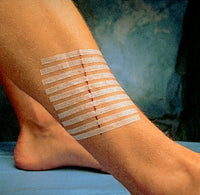 Thumbnail for 3M Steri-Strip™ Skin Closures, Reinforced, 1/4