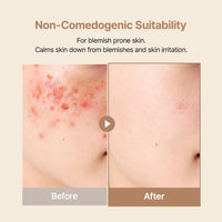 Thumbnail for PURITO Oat In Calming Gel Cream, Non-Comedogenic, 77% Oat Seed Water Lightweight Water-Gel Face Moisturizer, Fragrance-Free, Vegan Korean Skincare, Sensitive & Blemish-Prone Skin, 100 mL