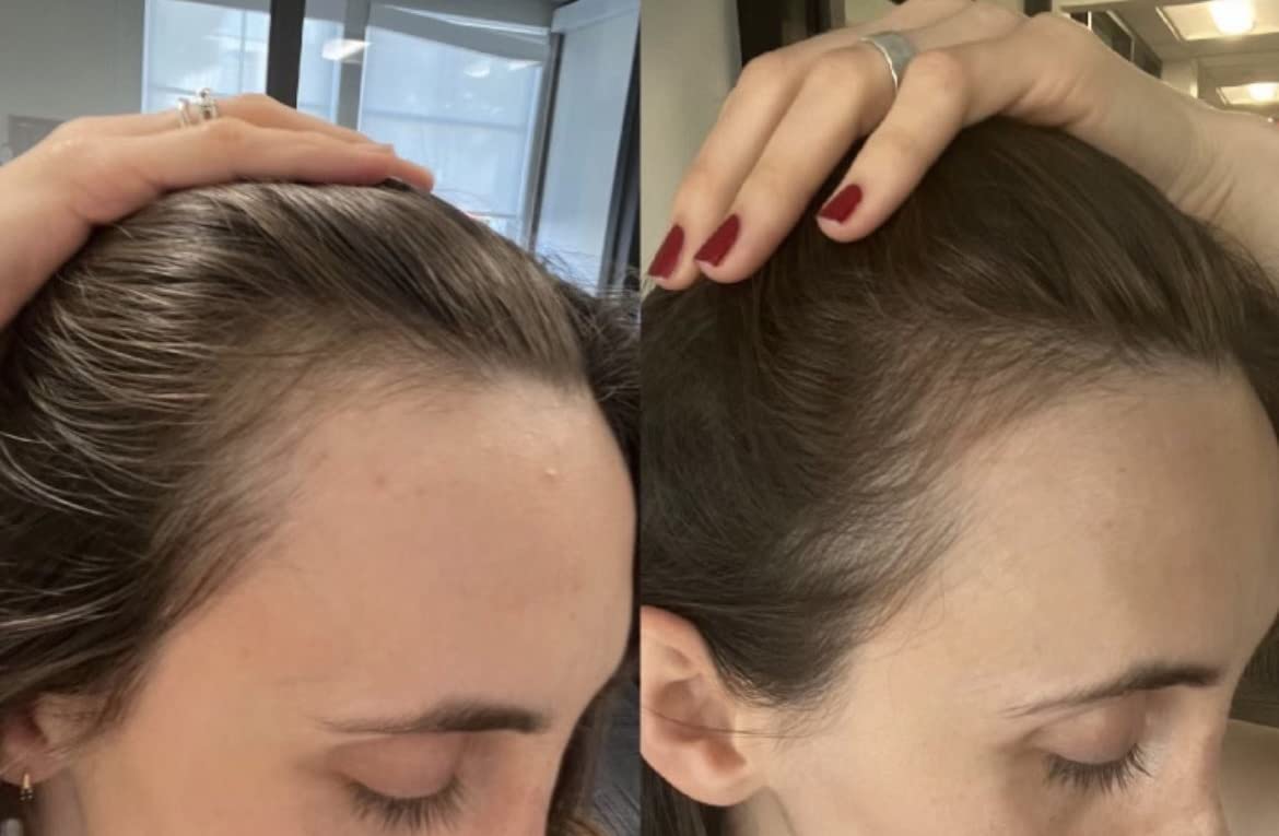 BUR BUR Growing Season Hair Growth And Repair Oil | With Burdock, Nettle Oil and Vitamin C for Visibly Fuller, Stronger and Shinier Hair.