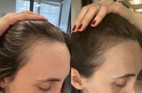 Thumbnail for BUR BUR Growing Season Hair Growth And Repair Oil | With Burdock, Nettle Oil and Vitamin C for Visibly Fuller, Stronger and Shinier Hair.