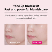 Thumbnail for ISOI Blemish Care Mask Pack 10EA, Hydrating and Clarifying Face Mask with Bulgarian Rose Oil, Korean Skin Care
