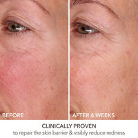 Thumbnail for Dr Dennis Gross DermInfusions Fill + Repair Serum: Immediately Fills Lines, Plumps & Repairs, 1 oz