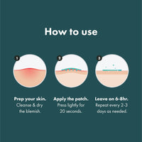 Thumbnail for Mighty Patch Micropoint™ for Blemishes from Hero Cosmetics - Hydrocolloid Acne Spot Treatment Patch for Early Stage Zits and Hidden Pimples, 395 Micropoints (8 Patches)