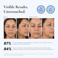 Thumbnail for Image 3 of EnaSkin Dark Spot Corrector & Remover Serum for Face & Body, Niacinamide