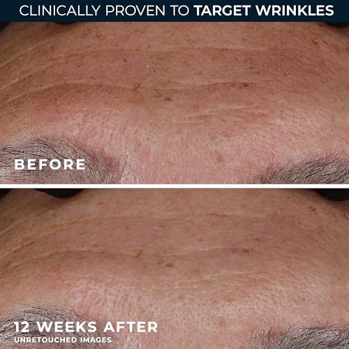 Image 5 of RoC Retinol Correxion Deep Wrinkle Retinol Face Serum, Ascorbic Acid, 1 0z