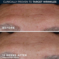 Thumbnail for Image 5 of RoC Retinol Correxion Deep Wrinkle Retinol Face Serum, Ascorbic Acid, 1 0z
