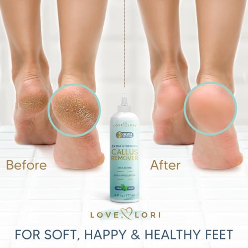Image 4 of LOVE, LORI Foot Callus Remover Gel Extra Strength Pedicure Tool for Feet 6oz