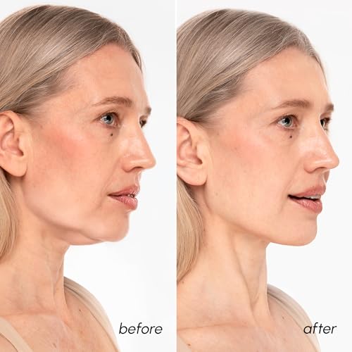 Image 4 of MAREE V Line Lifting Mask - 24K Gold Double Chin Lifting Mask 7 Ct