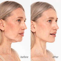 Thumbnail for Image 4 of MAREE V Line Lifting Mask - 24K Gold Double Chin Lifting Mask 7 Ct