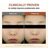 Thumbnail for Image 6 of BY WISHTREND Mandelic Acid Gentle Exfoliating Toner Sensitive Skin 5.07 Oz.