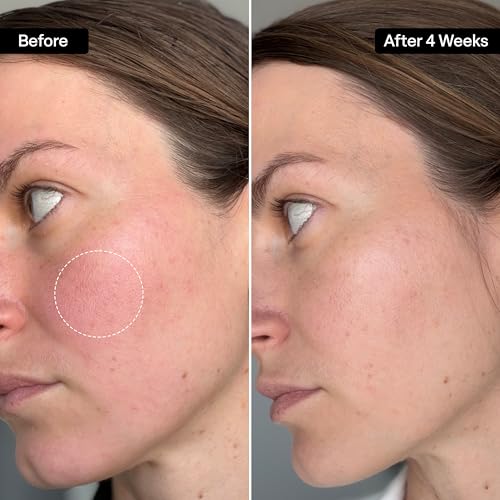 Image 3 of QRxLabs Squalane Oil - Dermaplane & Gua Sha Massage - Value Size - 2oz