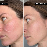 Thumbnail for Image 3 of QRxLabs Squalane Oil - Dermaplane & Gua Sha Massage - Value Size - 2oz