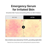 Thumbnail for Image 4 of B_LAB Ji-chi Hydro Boost Layer Serum 30ml