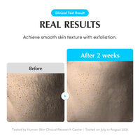 Thumbnail for EQQUALBERRY Swimming Pool Toner - Korean Toner for Daily Exfoliating & Deep Hydration with Natural Enzyme Protease & Hyaluronic Acid, For Sensitive Skin, 10.14 Fl Oz (300ml)