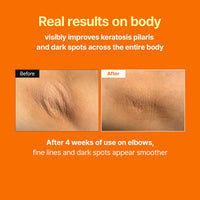 Thumbnail for MEDITHERAPY Retinal Skin Booster Serum | Retinaldehyde, Niacinamide Anti-Aging Serum - K-Beauty Facial Serum for Fine Lines, Firming & Radiance | Hydrating Face Serum All Skin Types, 5.07 fl oz