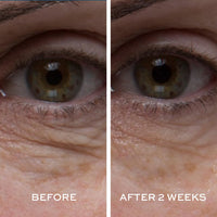 Thumbnail for ELEMIS Peptide4 Eye Recovery Cream, Reviving Eye Cream, 0.5 Fl Oz