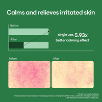 Thumbnail for Mediheal Teatree Calming Serum 1.35 fl.oz - Skin Calming and Sebum Care & Deep Moisturization - with Hyaluronic Acid