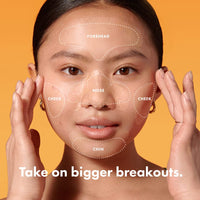 Thumbnail for Mighty Patch™ Face Patch from Hero Cosmetics - XL Hydrocolloid Face Mask for Acne, 5 Large Pimple Patches for Zit Breakouts on Nose, Chin, Forehead & Cheeks - Korean Skin Care (1 Count)