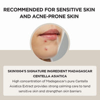 Thumbnail for SKIN1004 Madagascar Centella Asiatica Ampoule Facial Serum 1.85 fl.oz, 55ml, Soothes Acne Prone and Sensitive Skin