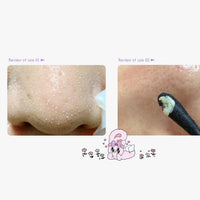 Thumbnail for ilso Natural Mild Clear Nose Patch, Melt blackheads & Tighten Pores, no irritation, Korean skincare, cotton swabs included, 5 sheets (Esther Bunny Limited Edition) (PINK Esther Bunny Limited Edition)